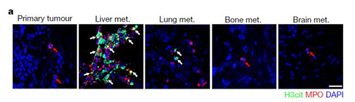 转入幼鼠模型得到一样的试验了局，且在转移产生前NET已在肝脏聚积。