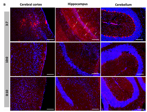 被包裹在含有NT-类脂质的LNP中的Cre沉组酶成功转移。大脑中的转染神经元呈红色高亮。