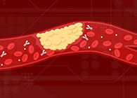 【Science快递】攻克COVID-19里程碑：已确定血凝块形成原因！