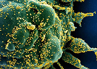 唾液检测新冠抗体新步骤来了，获取了局仅需几幼时！