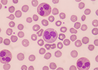 一种神秘颗粒被发现了！它能否成为败血症早筛标志物？