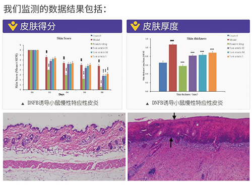 BB贝博成立的特应性皮炎及湿疹模型监测数据了局