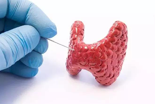 甲状腺疾病，蕴含甲状腺职能减退和甲状腺职能亢进，自古以来就是反复被医学钻研人员钻研的疾病